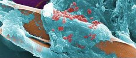 تاثیرات نانو ذرات برای درمان عفونت های باکتریایی